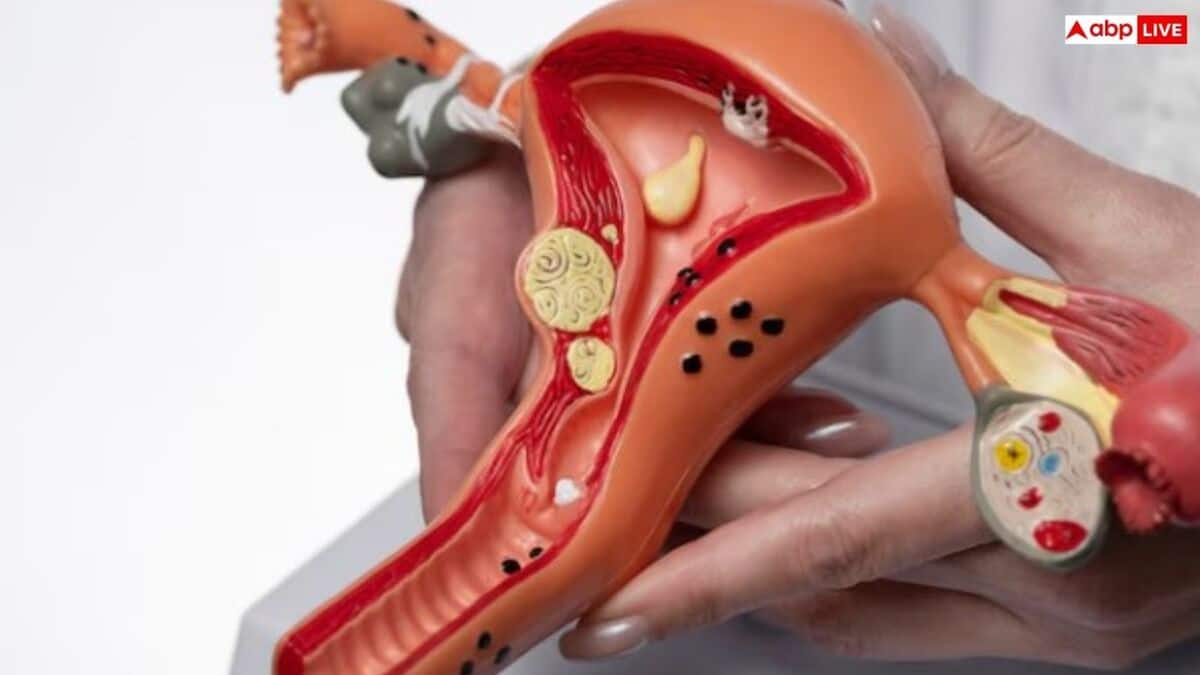 क्या पीसीओएस होने पर प्रेगनेंसी में आती है परेशानी, इसे ठीक कैसे किया जा सकता है