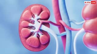 किडनी स्टोन की घंटी बजने से पहले जान लें जरूरी बातें, डॉक्टर के पास नहीं जाना पड़ेगा