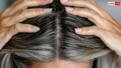 उम्र से पहले ही सफेद हो रहे हैं बाल? ये देसी उपाय आएंगे आपके काम