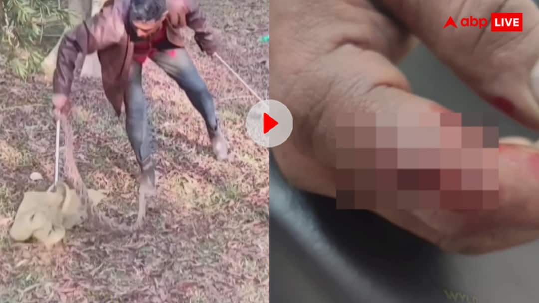 Watch Man rescuing snake was bitten by Russell Viper video goes viral on social media मौत का दूसरा नाम रसेल वाइपर...रेस्क्यू कर रहे शख्स को उछलकर काटा- खौफनाक वीडियो वायरल