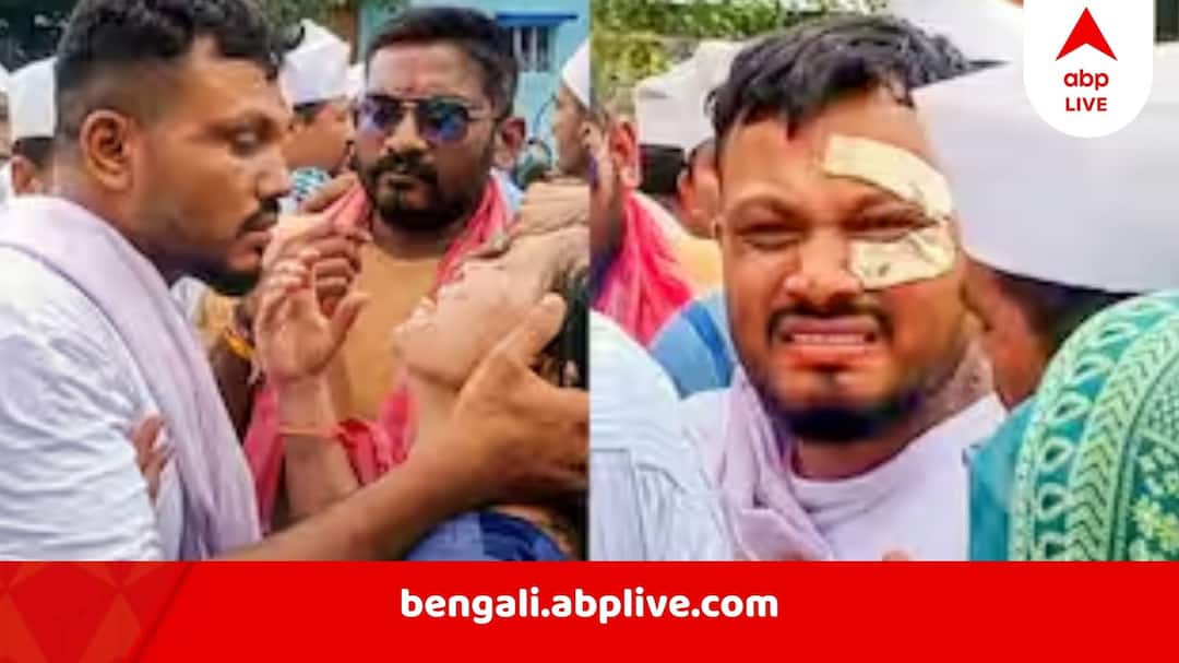 Ahmedabad Plane Crash: কিছুতেই কাটছে না ট্রমা, বাক্শক্তিহীন হয়ে পড়েছেন আমদাবাদ বিমান দুর্ঘটনা থেকে বেঁচে ফেরা বিশ্বাসকুমার রমেশ, চলছে মানসিক চিকিৎসা Vishwas Kumar Ramesh lone survivor of Ahmedabad Plane Crash is in trauma taking Psychiatric Help does not talk to anybody Ahmedabad Plane Crash: কিছুতেই কাটছে না ট্রমা, বাক্শক্তিহীন হয়ে পড়েছেন আমদাবাদ বিমান দুর্ঘটনা থেকে বেঁচে ফেরা বিশ্বাসকুমার রমেশ, চলছে মানসিক চিকিৎসা