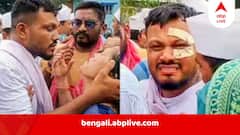 কিছুতেই কাটছে না ট্রমা, বাক্শক্তিহীন হয়ে পড়েছেন আমদাবাদ বিমান দুর্ঘটনা থেকে বেঁচে ফেরা বিশ্বাসকুমার রমেশ, চলছে মানসিক চিকিৎসা