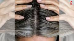 Hair Care: বয়সের আগেই চুল সাদা ? রইল ঘরোয়া টিপস