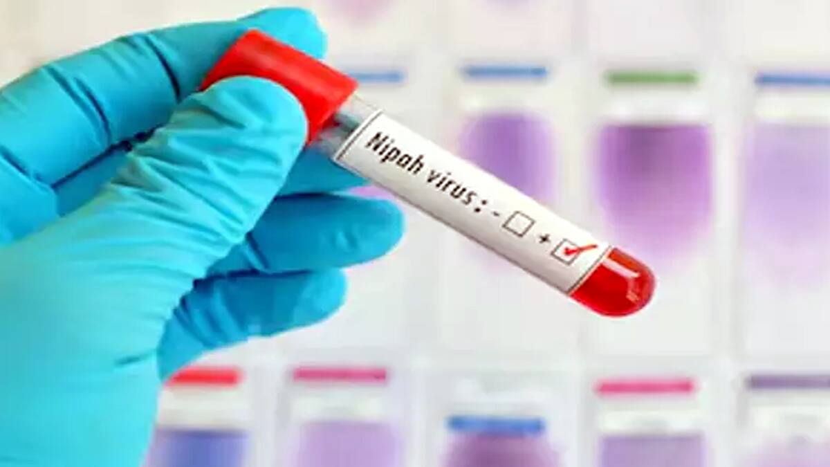 கேரளாவில் மீண்டும் நிபா வைரஸ் பீதி! பாலக்காட்டில் ஒருவர் உயிரிழப்பு, தடுப்பு நடவடிக்கைகள் தீவிரம்!