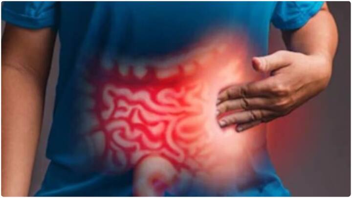 Gut Health Alert : పదేపదే గ్యాస్, అజీర్ణం లేదా ఉబ్బరంగా అనిపిస్తే పేగు ఆరోగ్యం సరిగా లేదని అర్థం. మీ పేగు ఆరోగ్యాన్ని బలహీనపరిచే అలవాట్లు తెలుసుకొని రీసెట్ చేసుకోండిలా..
