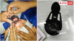 वॉटर बॉटल के सिपर में फंसी कक्षा 3 की छात्रा की जीभ, जानें बिना जीभ काटे कैसे निकाला ढक्कन?