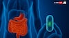 A Tiny Smart Pill That Can Read Your Gut And Be A Game-Changer In Diagnostics
