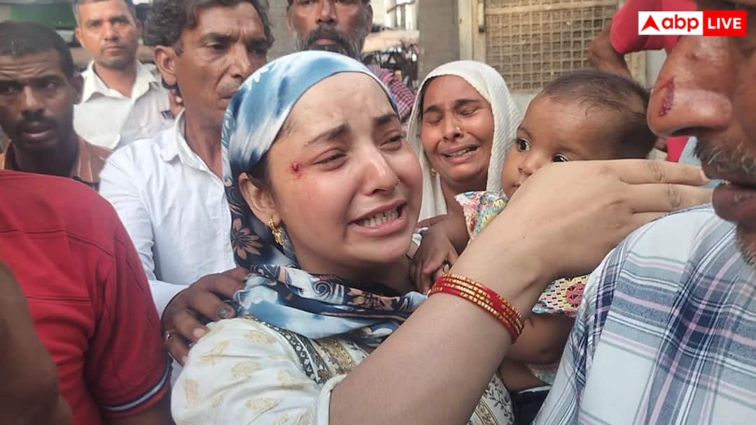 Hapur News: हापुड़ में अस्पताल स्टाफ पर गुंडई का आरोप, महिला मरीज और तीमारदारों की लाठी डंडों से पिटाई Up hapur female patient beaten by hospital staff relatives alleged ann Hapur News: हापुड़ में अस्पताल स्टाफ पर गुंडई का आरोप, महिला मरीज और तीमारदारों की लाठी डंडों से पिटाई