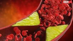 कोलेस्ट्रॉल कंट्रोल करने का नेचुरल तरीका, ये 6 बीज जरूर खाएं