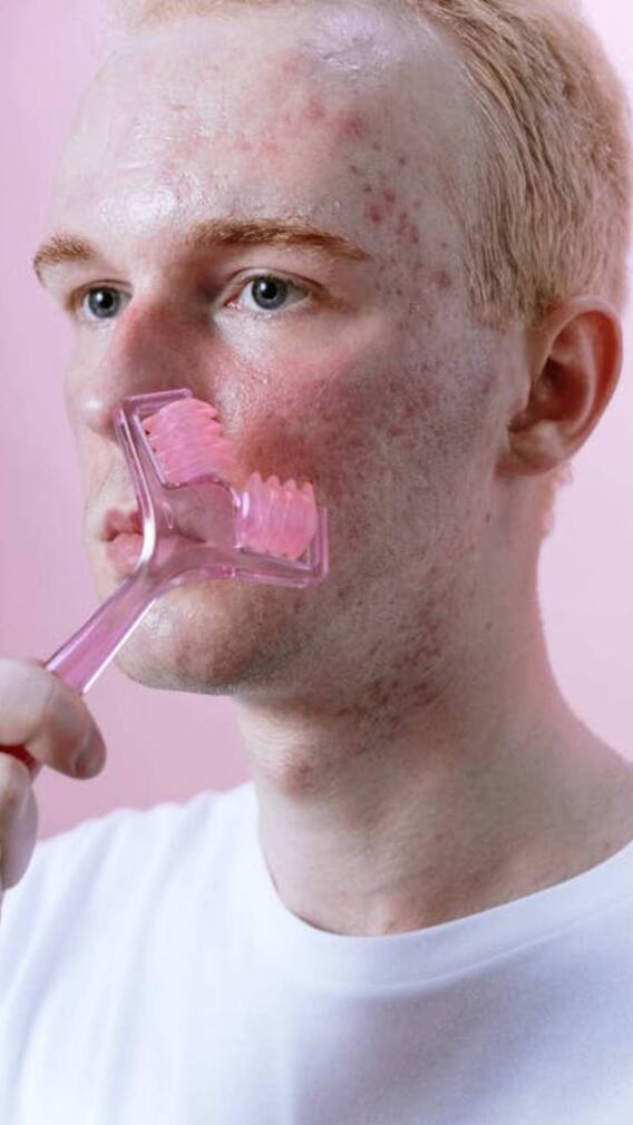 स्किन पर कैसे हो जाते हैं सफेद धब्बे?