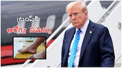 క్రానిక్ వీనస్ ఇన్సఫియెన్సీతో ఇబ్బంది పడుతోన్న ట్రంప్.. సమస్యకి కారణాలు, తీసుకోవాల్సిన జాగ్రత్తలు ఇవే