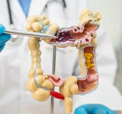 ਨੌਜਵਾਨਾਂ 'ਚ ਵਧ ਰਿਹਾ ਕੋਲਨ ਕੈਂਸਰ, ਸਮੇਂ 'ਤੇ ਲੱਛਣ ਪਛਾਣ ਕੇ ਬਚਾਈ ਸਕਦੀ ਜਾਨ