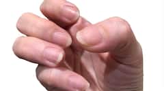 Nail Lines: ਨਹੁੰਆਂ 'ਤੇ ਦਿਖਾਈ ਦੇਣ ਇਹ ਲਾਈਨਾਂ ਤਾਂ ਸਰੀਰ 'ਚ ਇਸ ਚੀਜ਼ ਦੀ ਕਮੀ, ਜਾਣੋ ਕਿਵੇਂ ਕਿਡਨੀ ਫੇਲ੍ਹ ਹੋਣ ਵੱਲ ਦਿੰਦਾ ਇਸ਼ਾਰਾ?