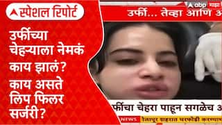 Urfi Javed : लिप फिलर की सौंदर्य किलर? उर्फी जावेदच्या चेहऱ्यावर नेमकी कोणती सर्जरी?
