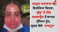 ਮਸ਼ਹੂਰ ਅਦਾਕਾਰਾ ਦਾ ਵਿਗੜਿਆ ਚਿਹਰਾ, ਬੁੱਲ੍ਹਾਂ 'ਤੇ ਟੀਕੇ ਲਗਵਾਉਣ ਤੋਂ ਬਾਅਦ ਸੁੱਜਿਆ ਮੂੰਹ; ਯੂਜ਼ਰ ਬੋਲੇ- 'ਕਾਰਟੂਨ'