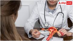 सर्वाइकल कैंसर की स्क्रीनिंग के लिए सही उम्र कौन-सही? जान लें हर बात कहीं हो न जाए देर