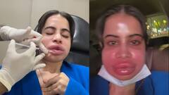 உயிர் போகும் வலி...உதட்டை பெரிதாக்க காஸ்மெடிக் சர்ஜரி செய்துகொண்ட பிரபல நடிகை..