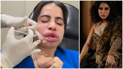 బెడిసి కొట్టిన లిప్ ఫిల్లర్ ట్రీట్​మెంట్.. గుర్తు పట్టలేనంతగా మారిపోయిన ఉర్ఫీ జావేద్ ఫేస్, కారణమిదే