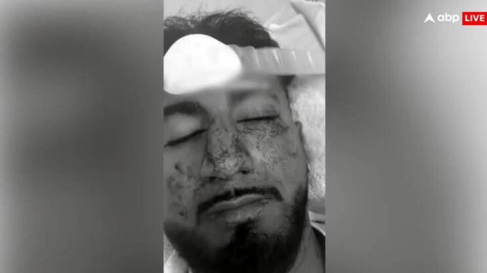 ਗੋਰਿਆਂ ਨੇ ਕੁੱਟਿਆ ਪੰਜਾਬੀ ਵਿਦਿਆਰਥੀ, ਤੋੜ ਦਿੱਤੀਆਂ ਸਰੀਰ ਦੀਆਂ ਕਈ ਹੱਡੀਆਂ, ਸ਼ਰੇਆਮ ਕੱਢੀਆਂ ਗਾਲਾਂ; ਕਿਹਾ- Go Indians charanpreet-singh-indian-student-kicked-punched-after-parking-spot-tiff-in-australia-racial-slurs-in-adelaide ਗੋਰਿਆਂ ਨੇ ਕੁੱਟਿਆ ਪੰਜਾਬੀ ਵਿਦਿਆਰਥੀ, ਤੋੜ ਦਿੱਤੀਆਂ ਸਰੀਰ ਦੀਆਂ ਕਈ ਹੱਡੀਆਂ, ਸ਼ਰੇਆਮ ਕੱਢੀਆਂ ਗਾਲਾਂ; ਕਿਹਾ- Go Indians