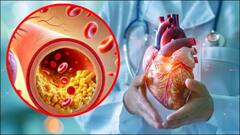 Health:હાર્ટ બ્લોકેજ ખોલી દે છે આ રસોડાના મસાલા, આ રીતે કરો ઉપયોગ, જાણો હાર્ટને હેલ્ધી રાખવાના ઉપાય