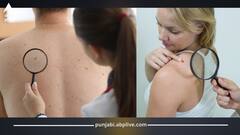 ਚਮੜੀ 'ਤੇ ਨਜ਼ਰ ਆਉਣ ਵਾਲੇ ਇਹ 5 ਨਿਸ਼ਾਨ ਦੱਸਦੇ ਨੇ ਕਿ ਦਿਲ ਹੋ ਸਕਦਾ ਬਿਮਾਰ, ਕਦੇ ਨਾ ਕਰੋ ਅਣਡਿੱਠਾ!