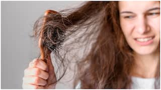 Hair Fall Causes in Rain : వర్షాకాలంలో జుట్టు ఎక్కువగా రాలుతుందా? బట్టతల తప్పదా? హెయిర్ ఎక్స్​పర్ట్స్ ఏమంటున్నారు?