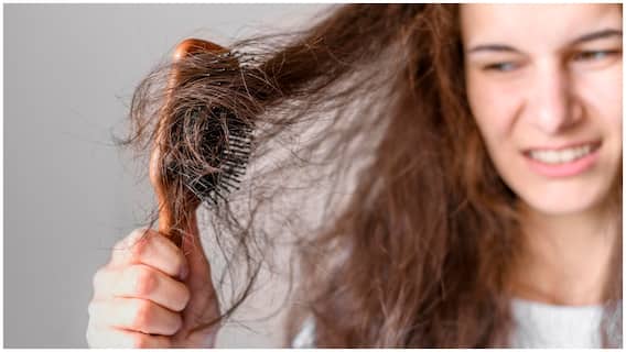 Hair Fall Causes in Rain : వర్షాకాలంలో జుట్టు ఎక్కువగా రాలుతుందా? బట్టతల తప్పదా? హెయిర్ ఎక్స్పర్ట్స్ ఏమంటున్నారు? Hair Fall Causes in Rain : వర్షాకాలంలో జుట్టు ఎక్కువగా రాలుతుందా? బట్టతల తప్పదా? హెయిర్ ఎక్స్పర్ట్స్ ఏమంటున్నారు?