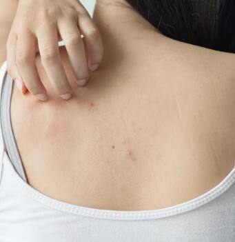 ਅੱਜਕੱਲ ਲੋਕ ਸਿਹਤ ਤੇ ਪੂਰਾ ਧਿਆਨ ਨਹੀਂ ਦੇ ਪਾਉਂਦੇ। ਖਾਣ-ਪੀਣ ਦੀਆਂ ਗਲਤ ਆਦਤਾਂ ਅਤੇ ਗਲਤ ਜੀਵਨ ਸ਼ੈਲੀ ਕਾਰਨ ਦਿਲ ਦੀ ਬਿਮਾਰੀ ਦਾ ਖ਼ਤਰਾ ਵੱਧ ਗਿਆ ਹੈ। ਜਦੋਂ ਅਸੀਂ ਦਿਲ ਦੀ ਬਿਮਾਰੀ ਦੀ ਗੱਲ ਕਰਦੇ ਹਾਂ ਤਾਂ ਅਕਸਰ ਛਾਤੀ ਦਰਦ ਜਾਂ ਥਕਾਵਟ ਨੂੰ ਹੀ ਲੱਛਣ ਮੰਨਦੇ ਹਾਂ, ਪਰ ਸਾਡੀ ਚਮੜੀ ਵੀ ਦੱਸ ਸਕਦੀ ਹੈ ਕਿ ਦਿਲ ਸਿਹਤਮੰਦ ਹੈ ਜਾਂ ਨਹੀਂ।