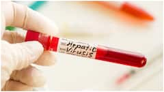 Hepatitis Day : హెపటైటిస్ ముట్టుకుంటే వచ్చేస్తుందా? వాస్తవాలు కచ్చితంగా తెలుసుకోవాలంటోన్న వైద్యులు