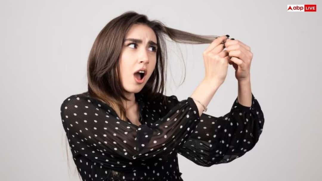 मानसून में ऑयली स्कैल्प से मिलेगा छुटकारा, अपनाएं ये आसान उपाय how to cure sticky hair in monsoon मानसून में ऑयली स्कैल्प से मिलेगा छुटकारा, अपनाएं ये आसान उपाय