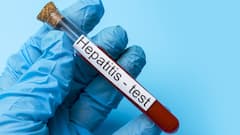 World Hepatitis Day 2025 — What India's Diagnostics Say About Hepatitis Readiness