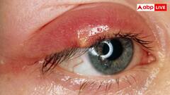 तेजी से बढ़ रही गांठ हो सकती है अंदरूनी कैंसर की निशानी, लक्षण महसूस होते ही दौड़ें डॉक्टर के पास