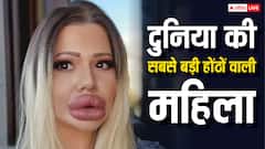 ये है दुनिया की सबसे बड़े होंठों वाली महिला, शक्ल बिगाड़ने के लिए खर्च कर दिए 26000 डॉलर