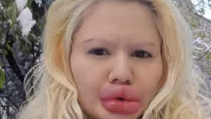 इस महिला का नाम है एंड्रिया इवानोवा है, जो कि एक नर्सिंग स्टूडेंट थीं. उनकी एक सादगी भरी, बेहद मासूम और नेचुरल मुस्कान थी. लेकिन अब 28 साल की ये बुल्गारियन सोशल मीडिया इन्फ्लुएंसर चर्चा में हैं.