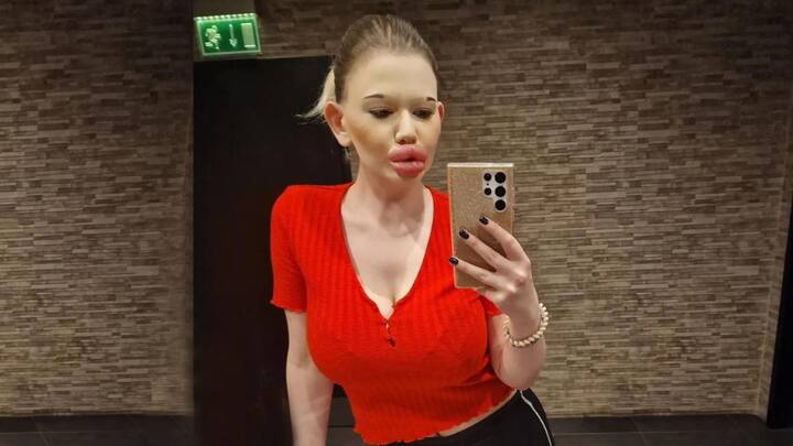 एंड्रिया को दुनिया की सबसे बड़े होठों वाली महिला कहा जाता है. उन्होंने अब तक 22.5 लाख रुपये से ज्यादा का खर्चा सिर्फ अपने रूप को बदलने के लिए कर दिया है.