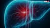 Liver Disease Warning: लिवर की दुश्मन हैं ये 3 चीजें, क्या आप भी कर रहे हैं ये गलती?