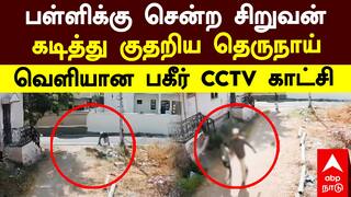 Dog Bite School Children |Dog Bite School Children |பள்ளிக்கு சென்ற சிறுவன் கடித்து குதறிய தெருநாய் வெளியான பகீர் CCTVகாட்சி