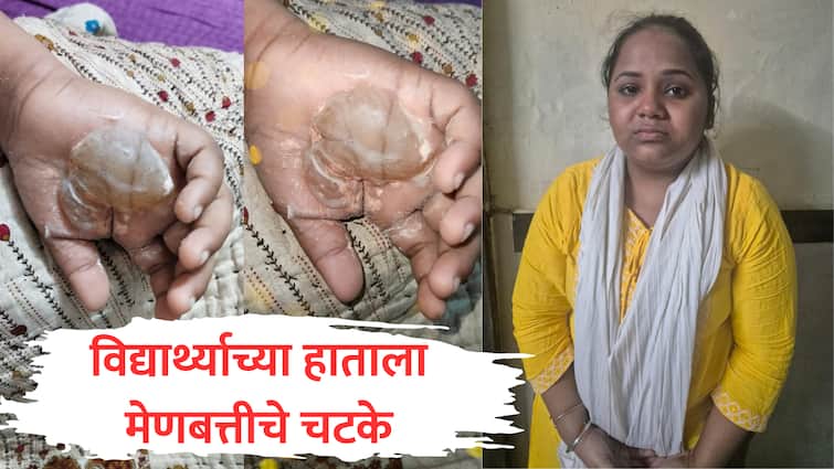 Malad Crime : हस्ताक्षर चांगलं नाही, 8 वर्षाच्या विद्यार्थ्याच्या हातावर मेणबत्तीने चटके दिले; ट्युशन शिक्षिकेविरोधात गुन्हा malad crime private tutor hits eight year old student on hand with candle because of bad handwriting mumbai news Malad Crime : हस्ताक्षर चांगलं नाही, 8 वर्षाच्या विद्यार्थ्याच्या हातावर मेणबत्तीने चटके दिले; ट्युशन शिक्षिकेविरोधात गुन्हा