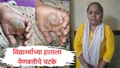 हस्ताक्षर चांगलं नाही, 8 वर्षाच्या विद्यार्थ्याच्या हातावर मेणबत्तीने चटके दिले; ट्युशन शिक्षिकेविरोधात गुन्हा