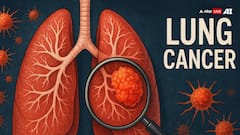 Lung Cancer Day: कैसे होती है लंग कैंसर की जांच, किस स्टेज तक बच सकती है मरीज की जान?