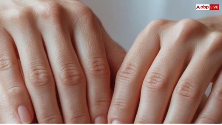हाथों का कालापन दूर करने का सरल उपाय, शीशे के जैसे चमक उठेंगे how to remove blackness of hands try these remedies हाथों का कालापन दूर करने का सरल उपाय, शीशे के जैसे चमक उठेंगे