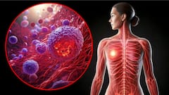 Covid, Flu May Reactivate Dormant Breast Cancer Cells, Trigger Lung Metastasis: Study