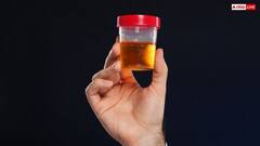 यूरीन से आ रही है बदबू, हो सकते हैं ये 5 गंभीर कारण...जानिए लक्षण