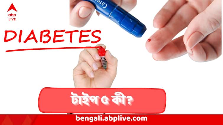 Type 5 Diabetes: টাইপ 5 ডায়াবেটিস কি অন্য সবরকম ডায়াবেটিসের চেয়ে ভয়ঙ্কর? কী এর লক্ষণ? কাদের হয়? Type 5 Diabetes Symptoms Over Type 1 Diabetes And Type To Diabetes Type 5 Diabetes: টাইপ 5 ডায়াবেটিস কি অন্য সবরকম ডায়াবেটিসের চেয়ে ভয়ঙ্কর? কী এর লক্ষণ? কাদের হয়?