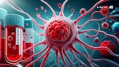 World Lung Cancer Day: साइलेंट किलर होता है ये वाला कैंसर, शुरुआत में तो बिल्कुल नहीं दिखते लक्षण और अचानक से...