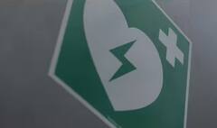 તમને ક્યારે આવશે હાર્ટ અટેક, AI અગાઉથી જ કરી દેશે ભવિષ્યવાણી