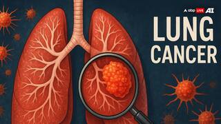 World Lung Cancer Day 2025: How Regular Exercise May Lower Lung Cancer Risk? Know Here