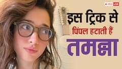 चेहरा का पिंपल हटाने के लिए ये अजीबोगरीब ट्रिक अपनाती थी तमन्ना भाटिया, जानकर पीट लेंगे माथा