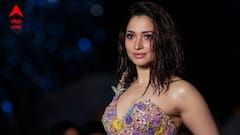 Tamannaah Bhatia: লালারস দিয়ে পিম্পল সারান তমন্না ভাটিয়া! এই পদ্ধতি আদৌ কি কাজ করে? কী বলছেন বিশেষজ্ঞরা?