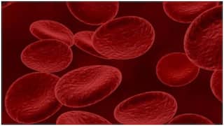 Cancer Detection : ఇంజెక్షన్, రేడియేషన్ లేకుండా క్యాన్సర్ గుర్తింపు.. సరికొత్త సాంకేతికతను తెరపైకి తెచ్చిన తాజా అధ్యయనం